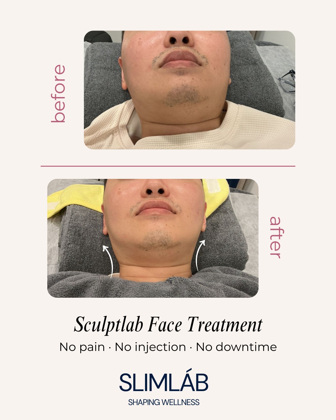 JEMOJE  - Quantum Glow Skin Brightening 