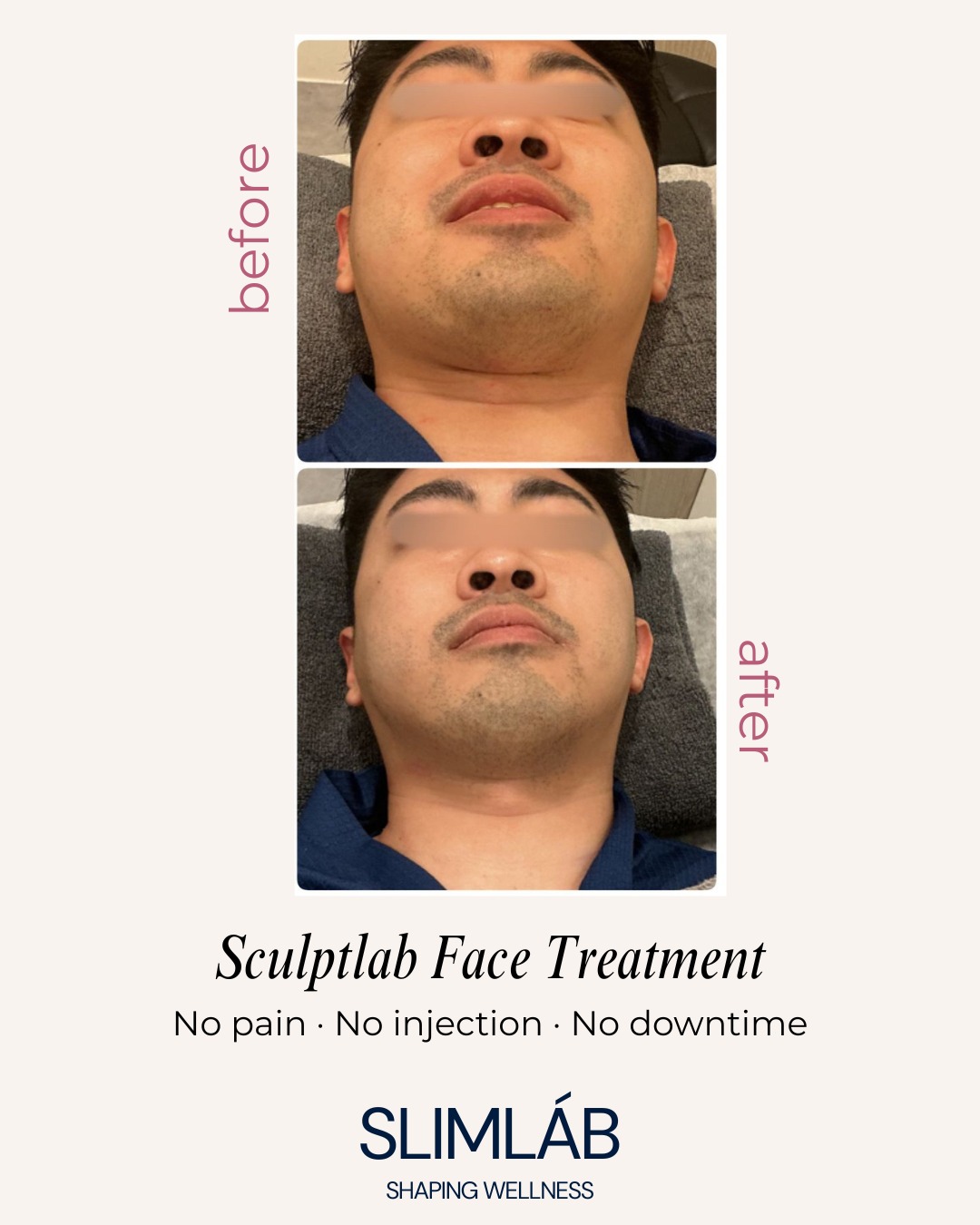 JEMOJE  - Quantum Glow Skin Brightening 